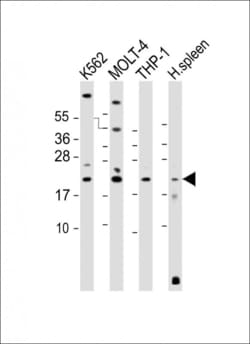 Invitrogen IBA1 Polyclonal Antibody 400 &mu;L; Unconjugated:Antibodies