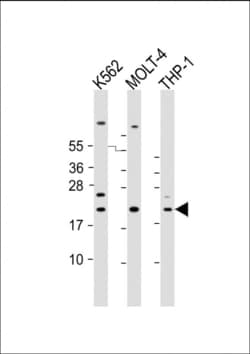 Invitrogen IBA1 Polyclonal Antibody 400 &mu;L; Unconjugated:Antibodies