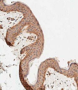 Invitrogen ALOXE3 Polyclonal Antibody 400 &mu;L; Unconjugated:Antibodies,