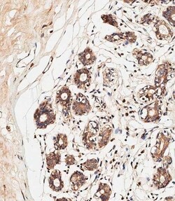 Invitrogen ALOXE3 Polyclonal Antibody 400 &mu;L; Unconjugated:Antibodies,