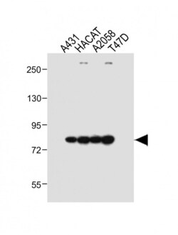 Invitrogen ALOXE3 Polyclonal Antibody 400 &mu;L; Unconjugated:Antibodies,