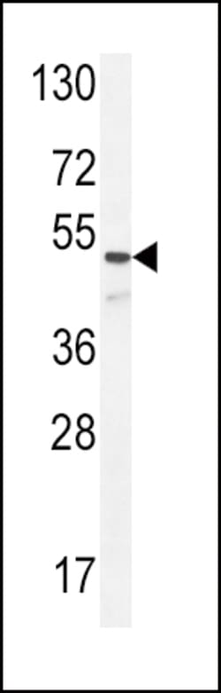 Invitrogen Angiopoietin 1 Polyclonal Antibody 400 &mu;L; Unconjugated:Antibodies,