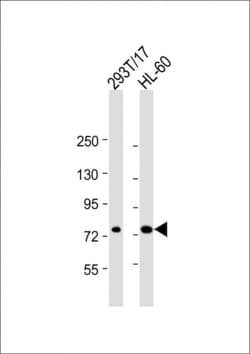 Invitrogen ABCD1 Polyclonal Antibody 400 &mu;L; Unconjugated:Antibodies,