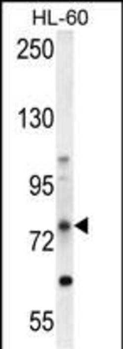 Invitrogen ABCD1 Polyclonal Antibody 400 &mu;L; Unconjugated:Antibodies,