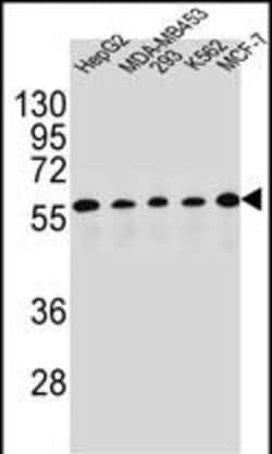 Invitrogen PAX1 Polyclonal Antibody 400 &mu;L; Unconjugated:Antibodies,