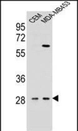 Invitrogen IL-12 p40 Polyclonal Antibody 400 &mu;L; Unconjugated:Antibodies,