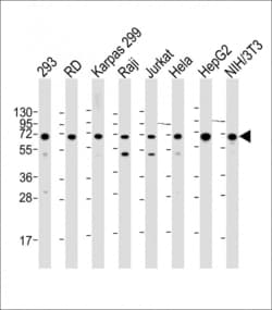 Invitrogen IGF2BP1 Polyclonal Antibody 400 &mu;L; Unconjugated:Antibodies,