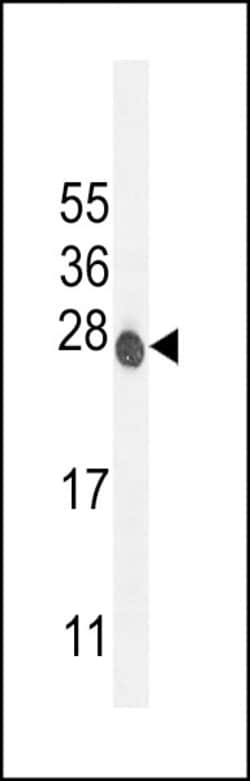 Invitrogen ATP6V0C Polyclonal Antibody 400 &mu;L; Unconjugated:Antibodies,