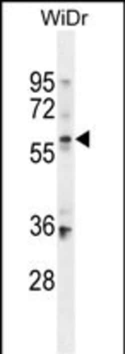 BCMO1 Polyclonal Antibody:Antibodies, Polyclonal