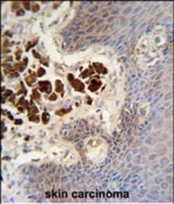Invitrogen COL19A1 Polyclonal Antibody 400 &mu;L | Buy Online | Invitrogen&trade; | Fisher Scientific