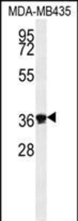 Invitrogen EXO5 Polyclonal Antibody 400 &mu;L; Unconjugated:Antibodies,