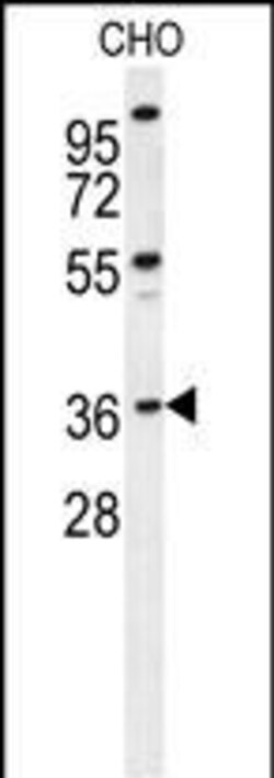 Invitrogen EXO5 Polyclonal Antibody 400 &mu;L; Unconjugated:Antibodies,