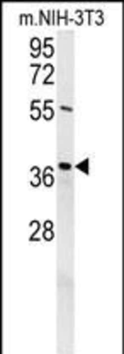 Invitrogen EXO5 Polyclonal Antibody 400 &mu;L; Unconjugated:Antibodies,