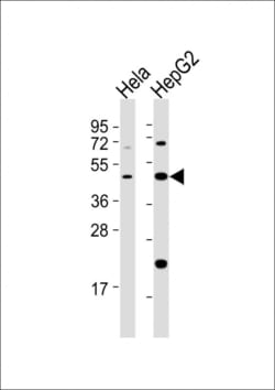 Invitrogen E2F2 Polyclonal Antibody 400 &mu;L; Unconjugated:Antibodies,