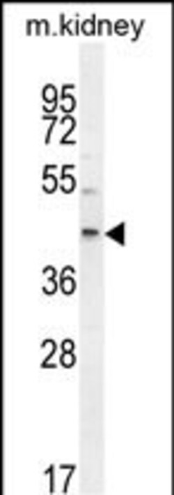 Invitrogen E2F2 Polyclonal Antibody 400 &mu;L; Unconjugated:Antibodies,
