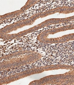 Invitrogen Collagen V Polyclonal Antibody 400 &mu;L; Unconjugated:Antibodies,