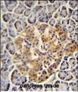 Invitrogen PRSS3 Polyclonal Antibody 400 &mu;L; Unconjugated:Antibodies,