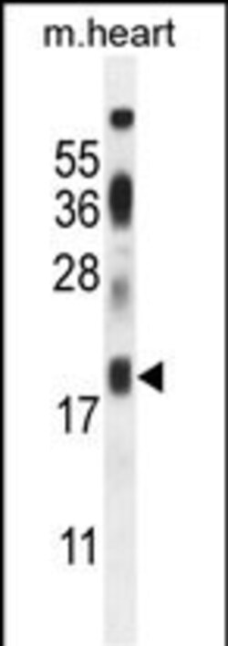 Invitrogen ISCA2 Polyclonal Antibody 400 &mu;L; Unconjugated:Antibodies,