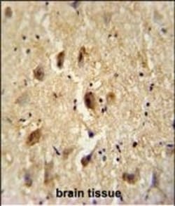 Vitrin Polyclonal Antibody:Antibodies, Polyclonal