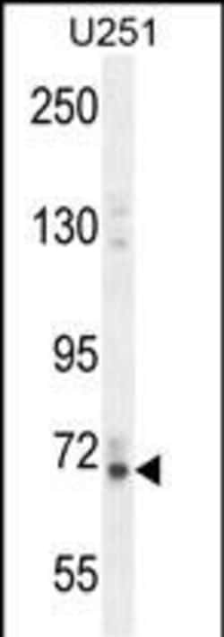Vitrin Polyclonal Antibody:Antibodies, Polyclonal