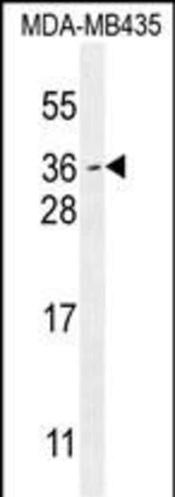 Invitrogen MYCT1 Polyclonal Antibody 400 &mu;L; Unconjugated:Anticuerpos