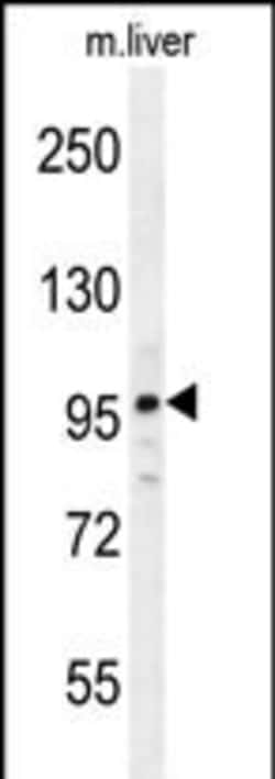 Invitrogen NARG2 Polyclonal Antibody 400 &mu;L; Unconjugated:Antibodies,