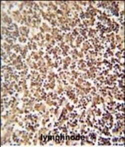 Invitrogen ZNF98 Polyclonal Antibody 400 &mu;L; Unconjugated:Antibodies,