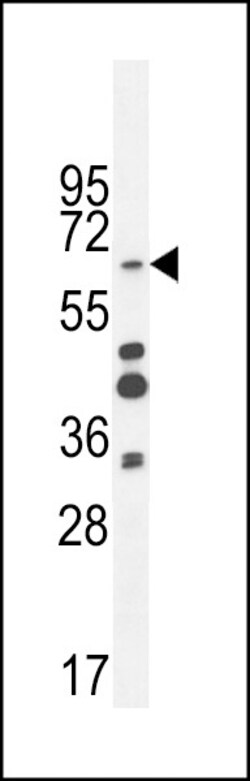 Invitrogen ZNF98 Polyclonal Antibody 400 &mu;L; Unconjugated:Antibodies,