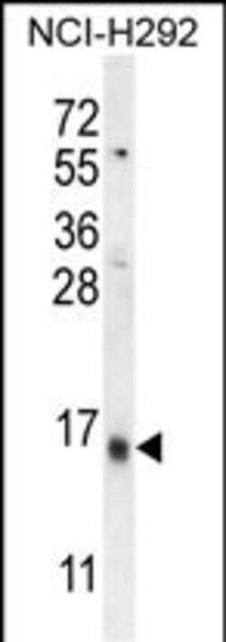 Invitrogen LY6G6C Polyclonal Antibody 400 &mu;L; Unconjugated:Antibodies,