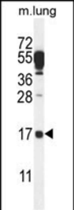 Invitrogen C14orf126 Polyclonal Antibody 400 &mu;L; Unconjugated:Antibodies,