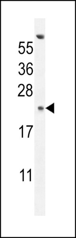 Invitrogen GAGE13 Polyclonal Antibody 400 &mu;L | Buy Online | Invitrogen&trade; | Fisher Scientific