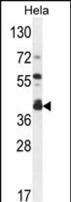 DEGS2 Polyclonal Antibody:Antibodies, Polyclonal