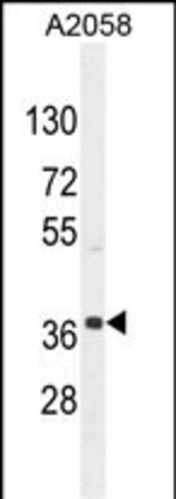 Invitrogen NKAPL Polyclonal Antibody 400 &mu;L | Buy Online | Invitrogen&trade; | Fisher Scientific
