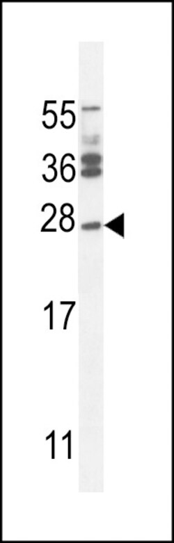Invitrogen JOSD2 Polyclonal Antibody 400 &mu;L; Unconjugated:Antibodies,