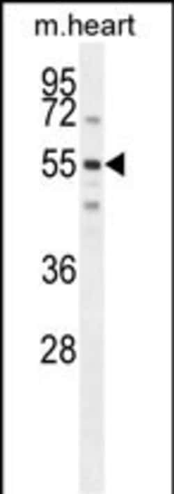 Invitrogen SPATC1 Polyclonal Antibody 400 μL; Unconjugated:Antibodies,