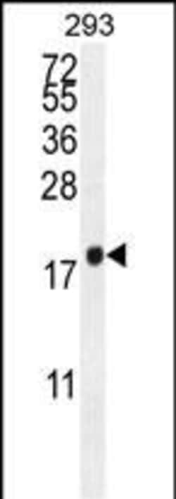 Invitrogen PCOTH Polyclonal Antibody 400 &mu;L | Buy Online | Invitrogen&trade; | Fisher Scientific
