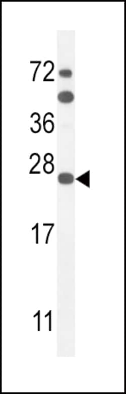 Invitrogen SCN1B Polyclonal Antibody 400 &mu;L; Unconjugated:Antibodies,