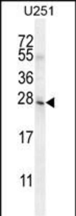 Invitrogen Mist1 Polyclonal Antibody 400 &mu;L; Unconjugated:Antibodies,