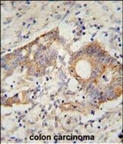Invitrogen HHLA2 Polyclonal Antibody 400 &mu;L | Buy Online | Invitrogen&trade; | Fisher Scientific