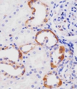 Invitrogen HHLA2 Polyclonal Antibody 400 &mu;L | Buy Online | Invitrogen&trade; | Fisher Scientific