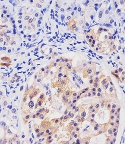 Invitrogen HHLA2 Polyclonal Antibody 400 &mu;L | Buy Online | Invitrogen&trade; | Fisher Scientific