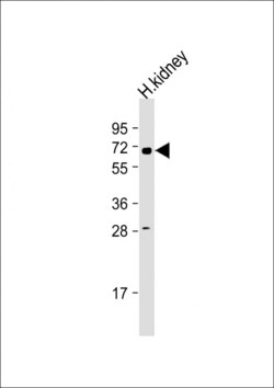 Invitrogen HHLA2 Polyclonal Antibody 400 &mu;L | Buy Online | Invitrogen&trade; | Fisher Scientific