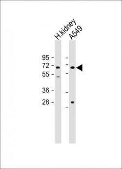 Invitrogen HHLA2 Polyclonal Antibody 400 &mu;L | Buy Online | Invitrogen&trade; | Fisher Scientific