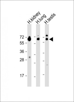 Invitrogen HHLA2 Polyclonal Antibody 400 &mu;L | Buy Online | Invitrogen&trade; | Fisher Scientific