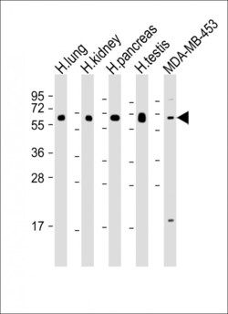 Invitrogen HHLA2 Polyclonal Antibody 400 &mu;L | Buy Online | Invitrogen&trade; | Fisher Scientific