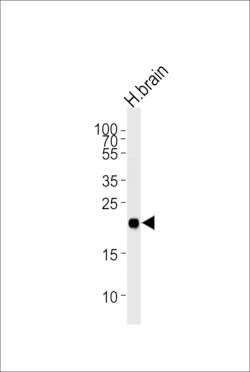 Invitrogen CPLX3 Polyclonal Antibody 400 &mu;L; Unconjugated:Antibodies,