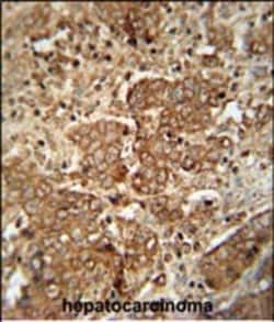 Invitrogen Serum Amyloid P Polyclonal Antibody 400 &mu;L; Unconjugated:Antibodies,