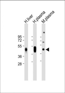 Invitrogen Haptoglobin Polyclonal Antibody 400 &mu;L; Unconjugated:Antibodies,