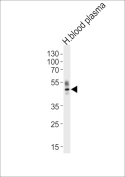 Invitrogen PON1 Polyclonal Antibody 400 &mu;L; Unconjugated:Antibodies,