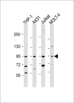 Invitrogen IL12RB2 Polyclonal Antibody 400 &mu;L; Unconjugated:Antibodies,